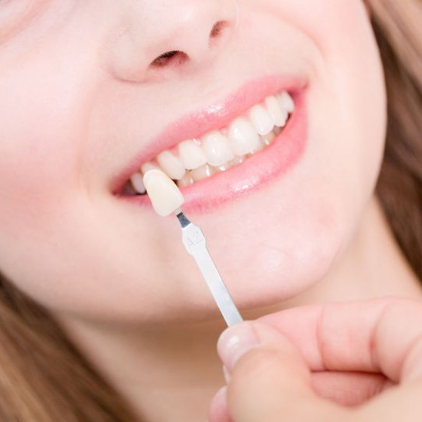 LENTE DE CONTATO E FACETA